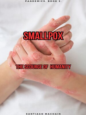 cover image of Smallpox